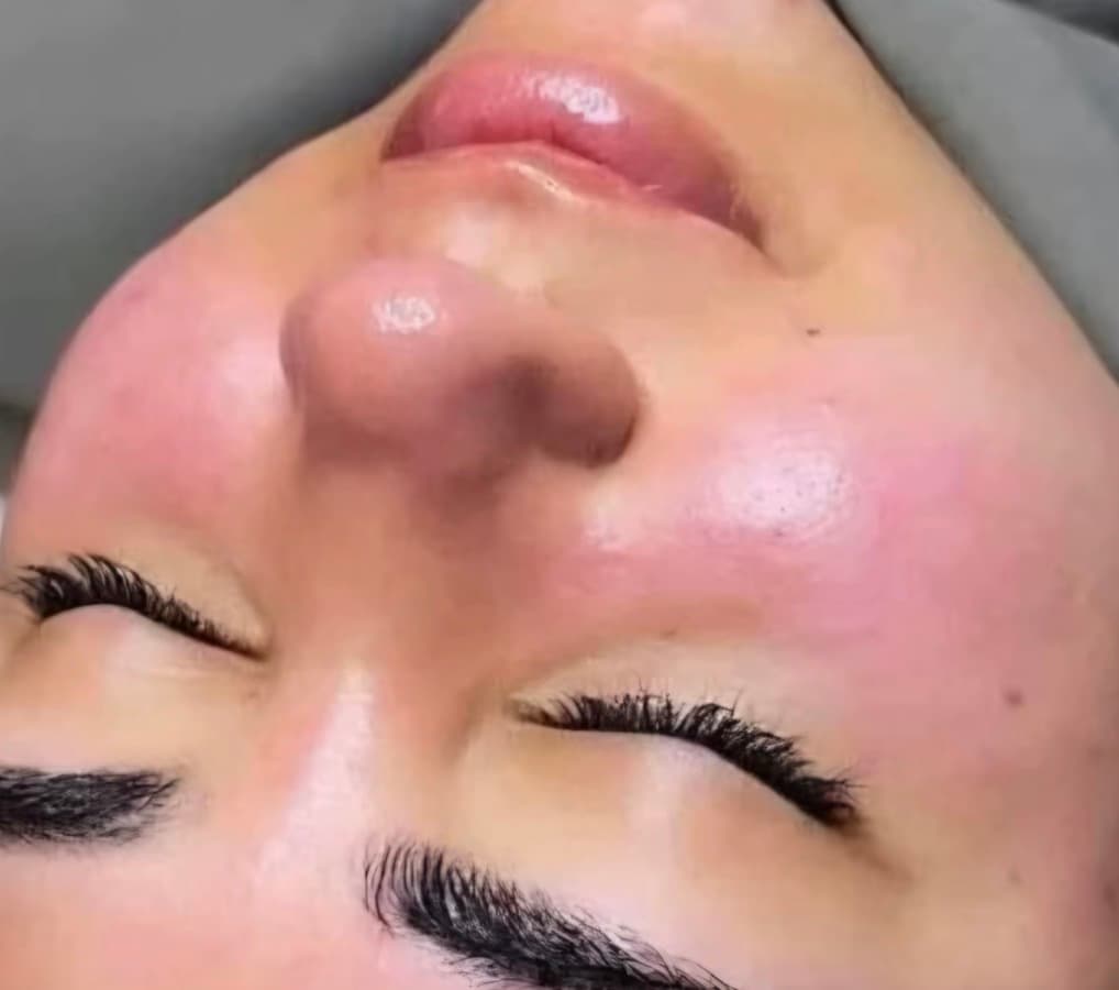 جلسة الاكسجينو 